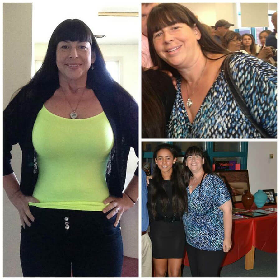 Sue Lost 96 lbs in Six Months