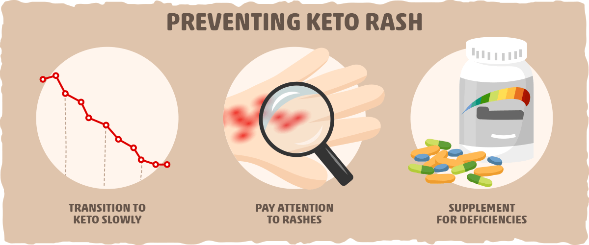 Can Keto Rash Be Prevented?