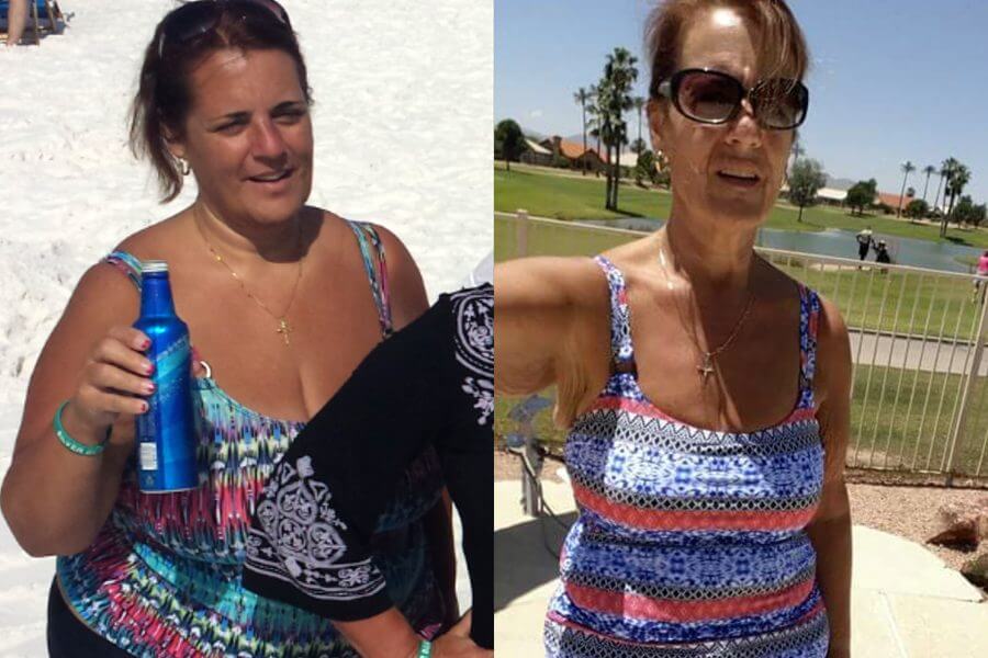 Susan Lost 85 Lbs and Stopped Her Stomach Issues